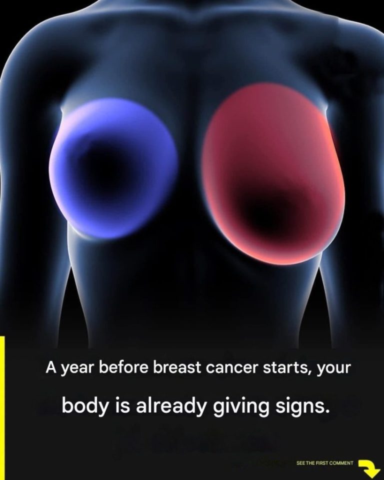 breast-cancer-4-early-signs-every-woman-should-rec cover