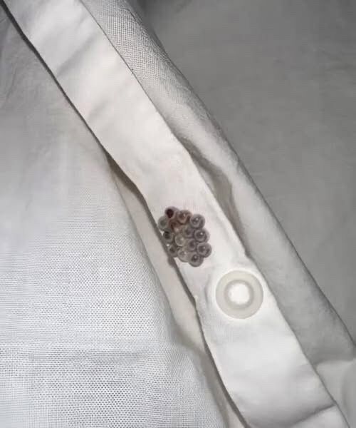 tiny-balls-in-the-bed-the-stink-bug-egg-scare-expl cover