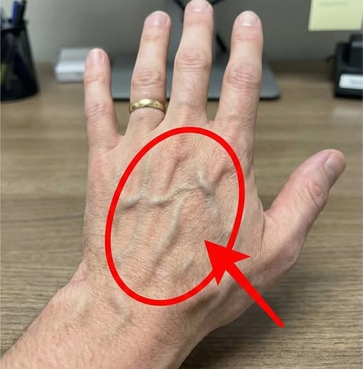 visible-veins-under-your-skin-when-to-worry-and-wh cover