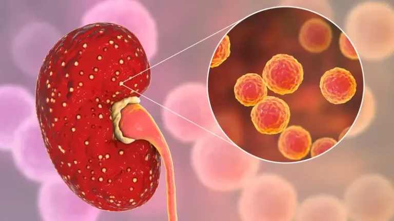23-early-signs-of-kidney-disease-that-are-easy-to- cover