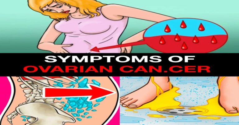 breast-and-ovarian-cancer-the-brca-gene-link-expla cover