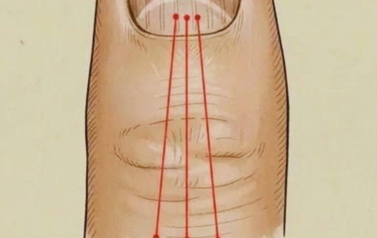 brittle-nails-these-3-nutrients-could-be-the-reaso cover