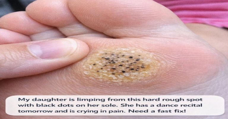 child-limping-before-a-recital-it-could-be-a-plant cover