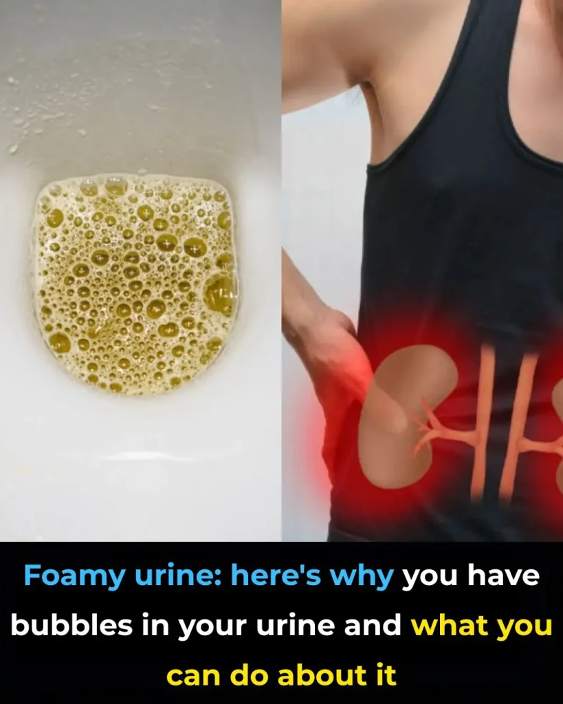 foamy-urine-the-6-causes-doctors-say-you-should-kn-cover foamy-urine-the-6-causes-doctors-say-you-should-kn cover