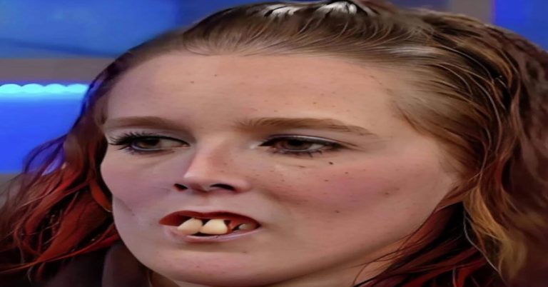 mocked-for-her-teeth-on-tv-gemma-swift-got-free-de cover