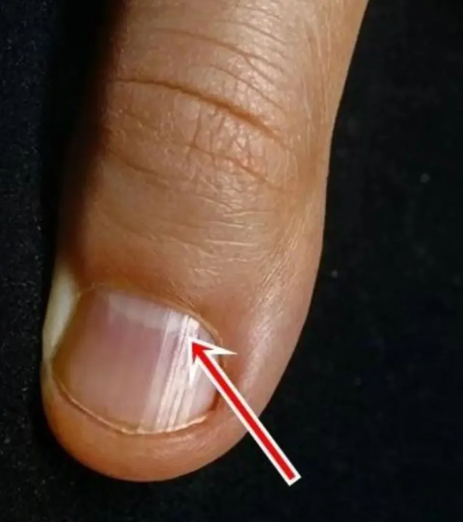 nail-lines-after-40-aging-or-a-sign-of-illness-cover nail-lines-after-40-aging-or-a-sign-of-illness cover