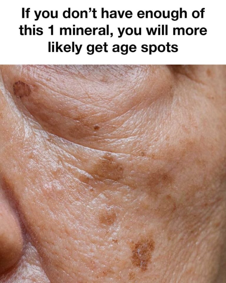 the-mineral-deficiency-that-may-trigger-age-spots cover